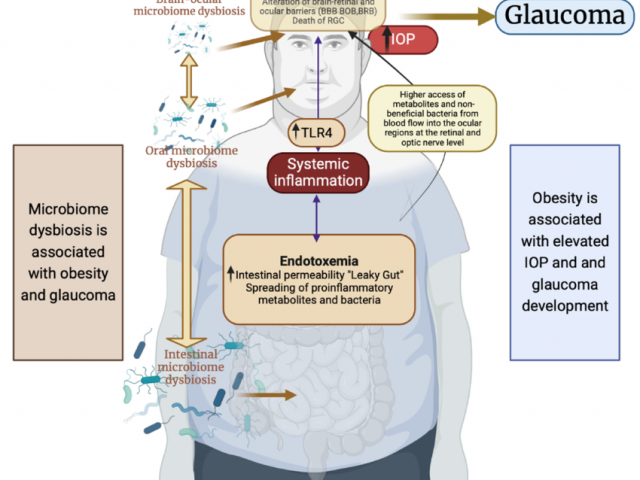 Le lien entre le microbiote et le glaucome – maladie oculaire caractérisée par des dommages progressifs du nerf optique